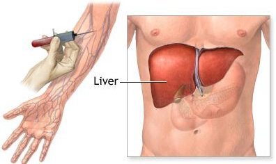 اعراض مرض الكبد بالتفصيل Liver 1113