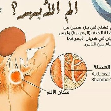 افضل طرق علاج الابهر 1181