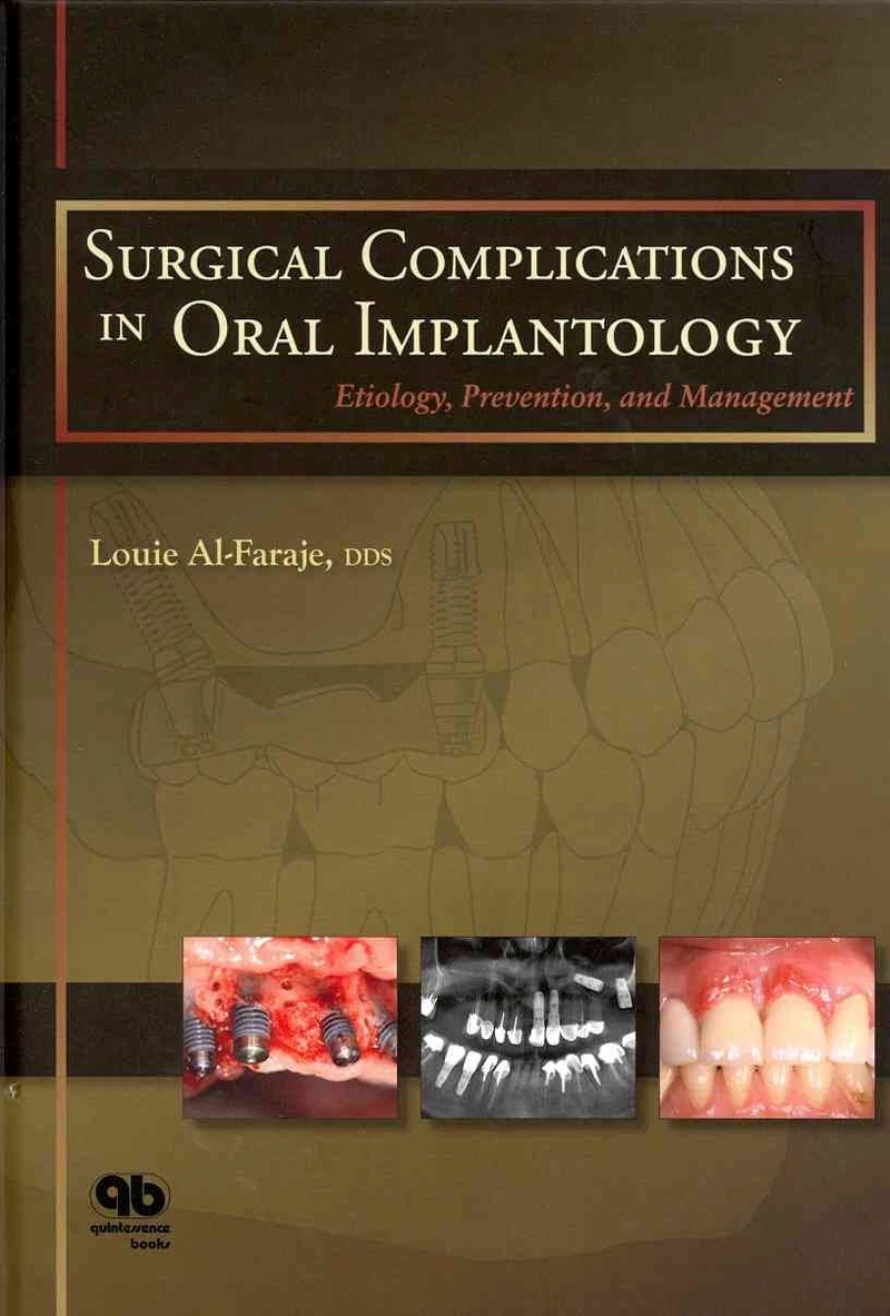 Request of SurgicalComplications in Oral Implantology Images10