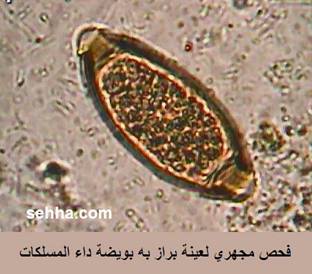 الطفيليات الاسطوانيه - nematode Nemato12