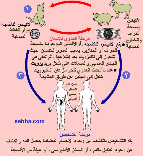 داء القطط - toxoplasmosis Toxopl10