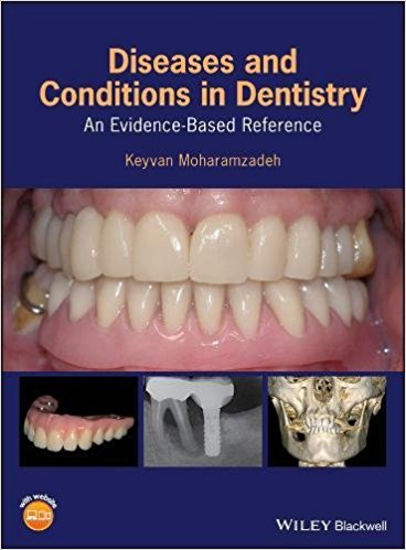 Diseases and Conditions in Dentistry: An Evidence–Based Reference Diseas11