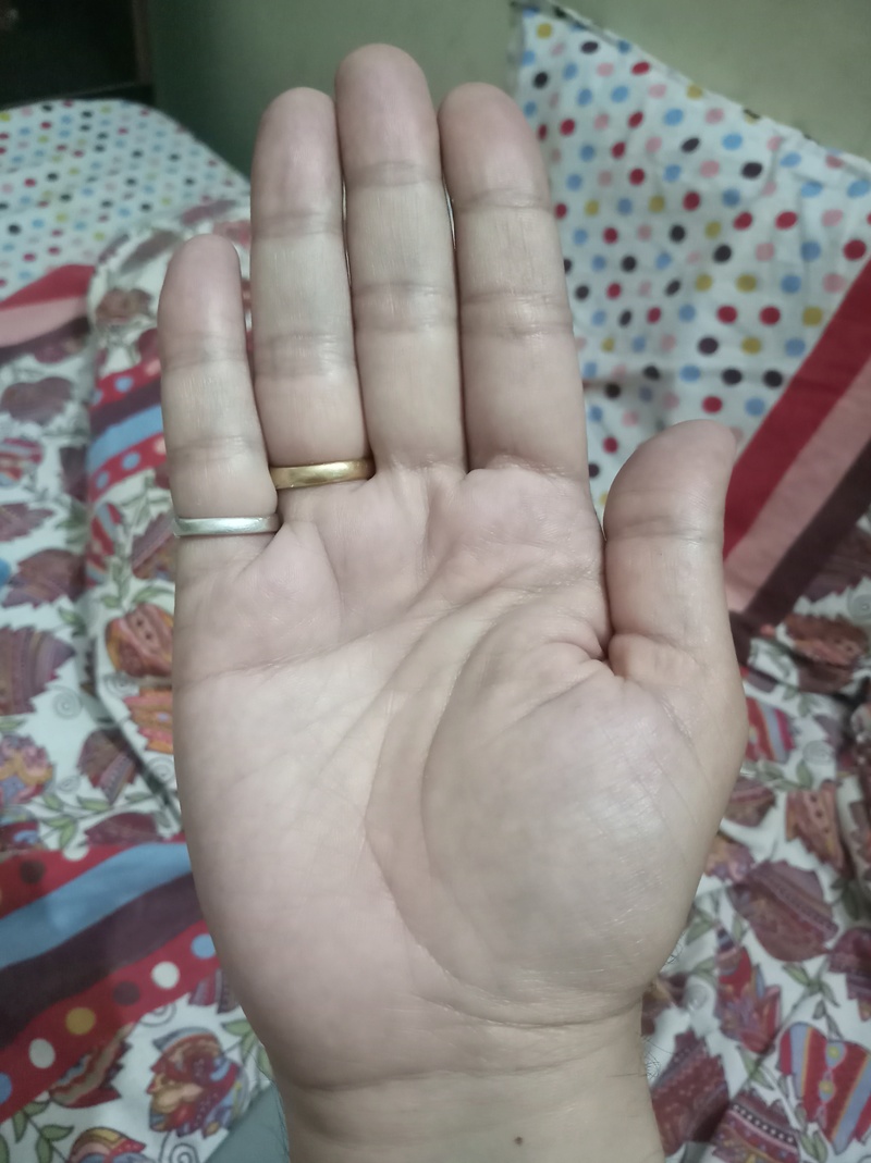 Not able to identify sign on my hand 20180410