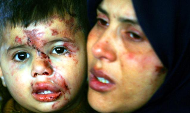 Crimes of Israeli army in Gaza Image025