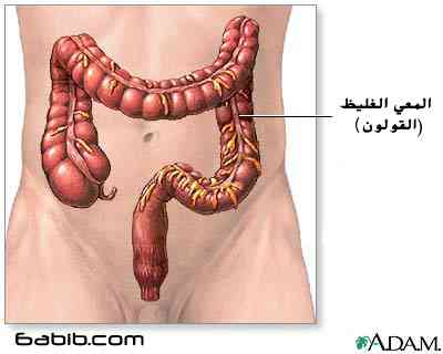 ((تهيج القولون)):- A11cb310