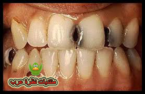 هل لأمراض الأسنان لها علاقة بالسرطان 12781811