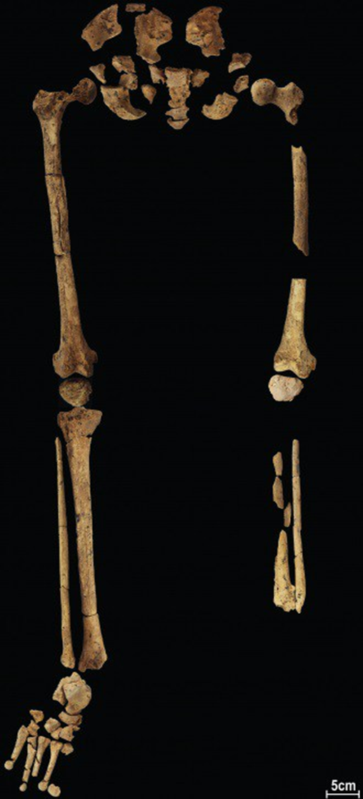 قدم هيكل عظمي مفقودة عمرها 31 ألف عام قد تظهر أقدم عملية بتر 1--247