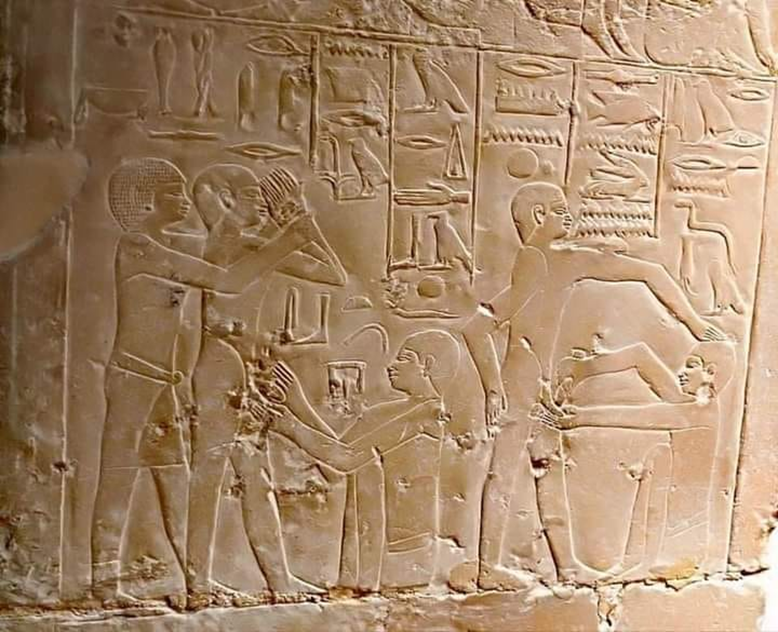 "الختان فى مصر القديمة " للذكور "  1-933