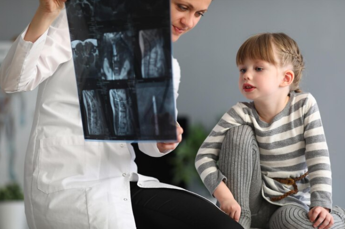 علاج تشوهات العظام عند الاطفال Screen11