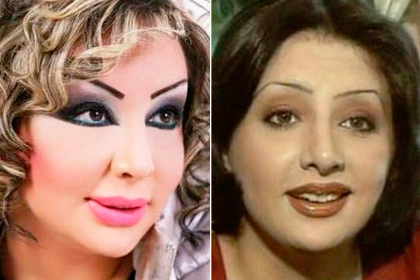  بالصور.. عمليات التجميل الفاشلة والناجحة للنجمات العرب 2010  15851510