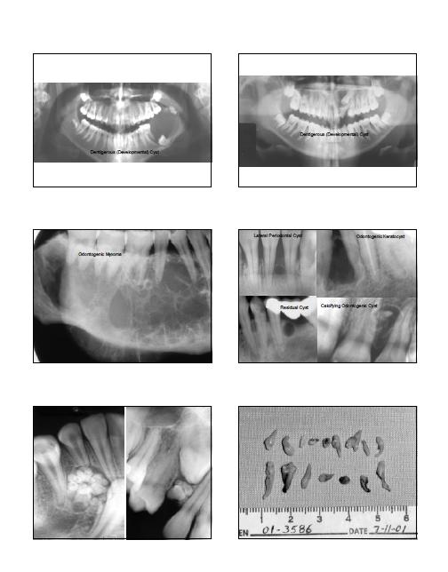 radiologie buccale Sans_t15