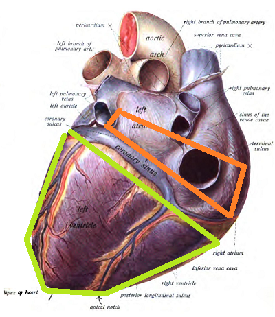 sillon coronaire face diaphragmatique  Coeur_10