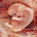 Embryologie