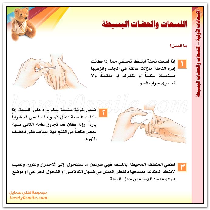 اللسعات والعضات البسيطة Esa-0511