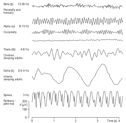 II] Les moyens technologiques d'exploration fonctionnelle du cerveau. Eeg210