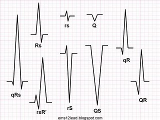 CHAPTER 3 : Basic waves part 2 Qrs_no10