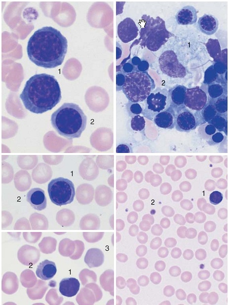 Color Atlas of Hematology1 Snap2_10