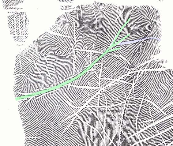 simian - How to discriminate a simian crease from a Sydney line and a Suwon crease! - Page 5 Suwon-14