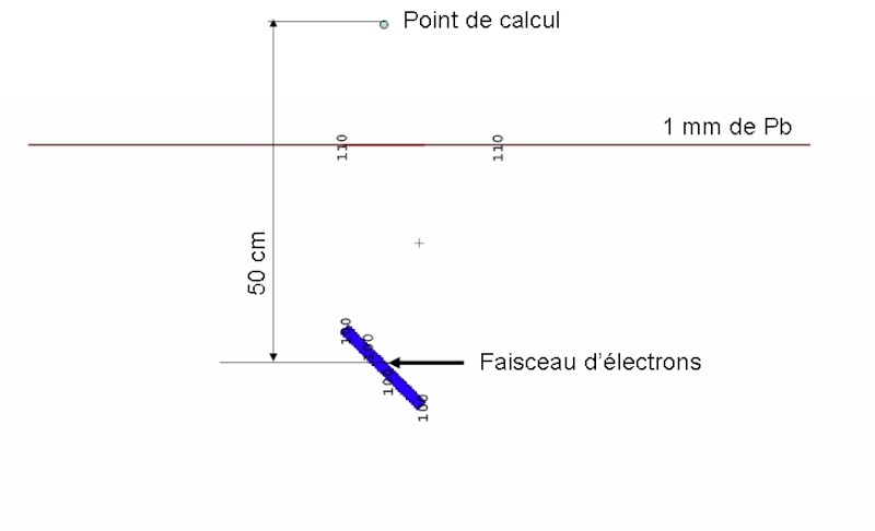 Où et quand mettre du plomb sur un patient ? Gaomat11