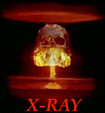 X-RAY