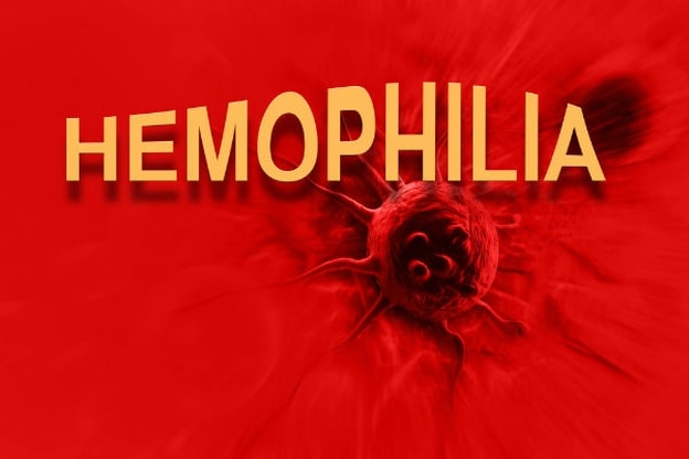 الهيموفيليا أو الناعور Hemophilia 10874912