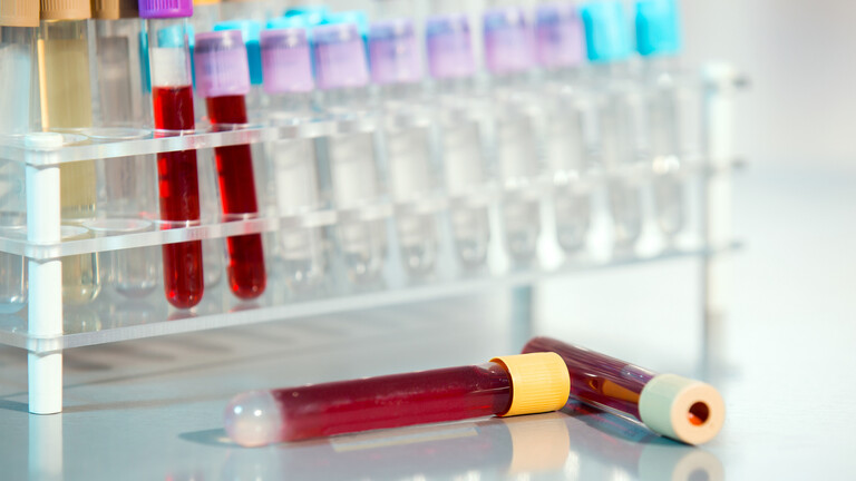 دراسة جديدة تشرح حقيقة العلاقة بين فصيلة الدم والإصابة بـ"كوفيد-19" الشديد 606c1010