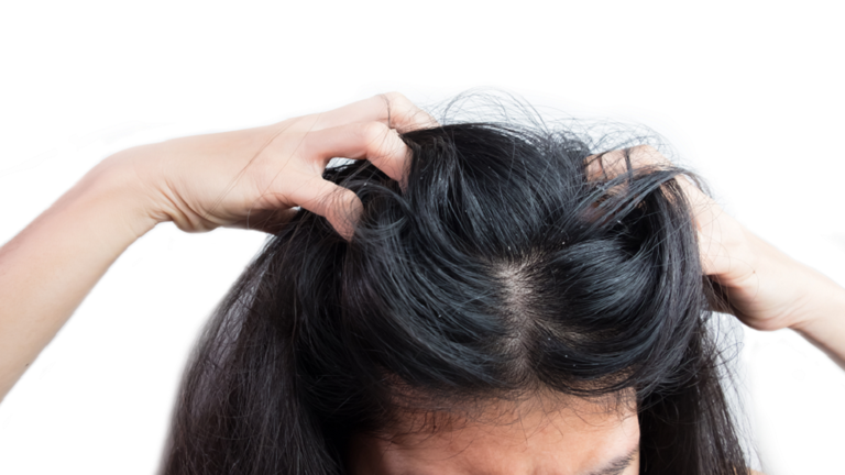 ما هو معدل نمو الشعر وهل توجد طريقة لتعزيز سرعة التنامي؟ 60acec10