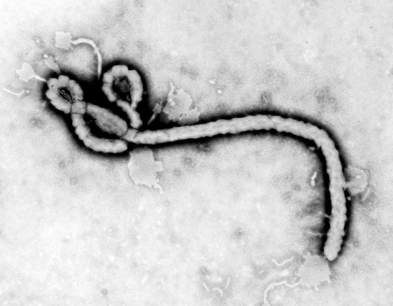 TEM & SEM Images Ebola11