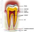 Tissus de soutien de la dent Paro11