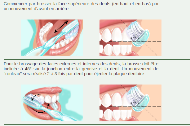 vidéo -  Technique de brossage des dents W110