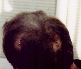 Piercing craneales! Brain-10