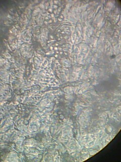 Sujets d'examens (Parasitologie) Img01710