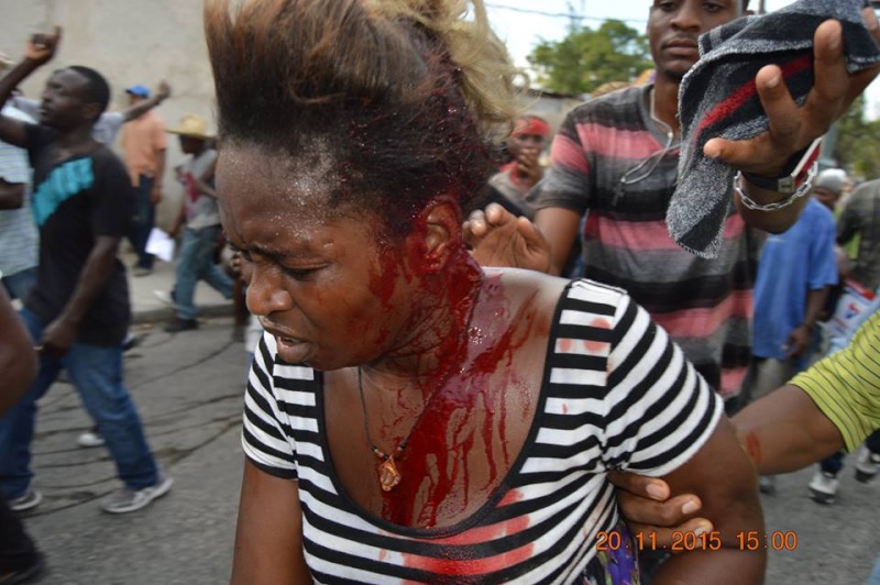 Haïti: un mort et un blessé grave lors d'une manifestation 12239610