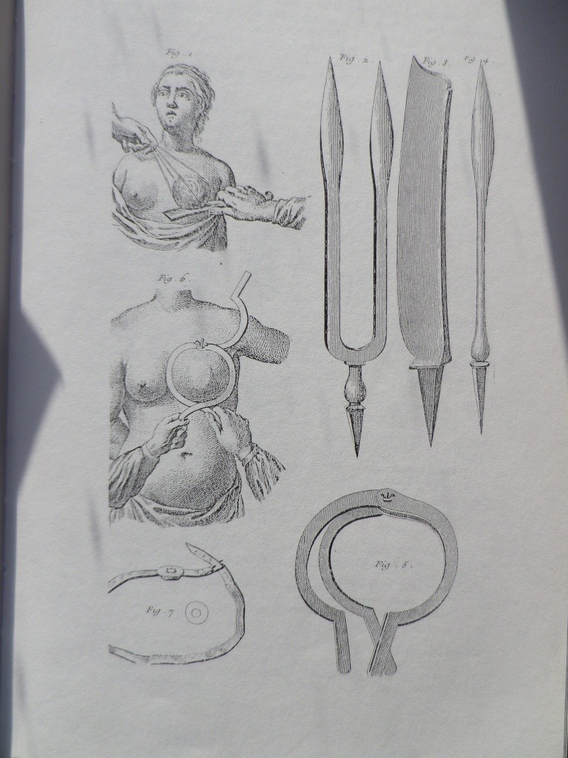 La Médecine des Lumières - Page 2 Alice_12