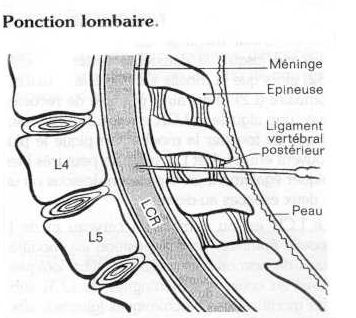 Examen Neurologique Poncti10