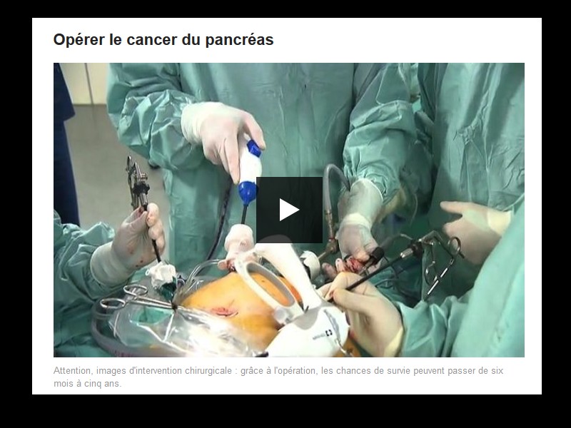 Cancer du pancréas : l'un des cancers les plus redoutés Sans_609