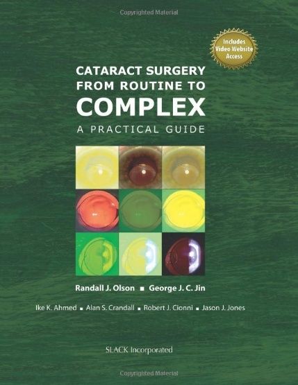 Cataract Surgery from Routine to Complex: A Practical Guide  Cover11
