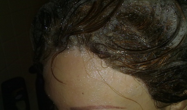 foto chica protesis total con shampoo 17112011
