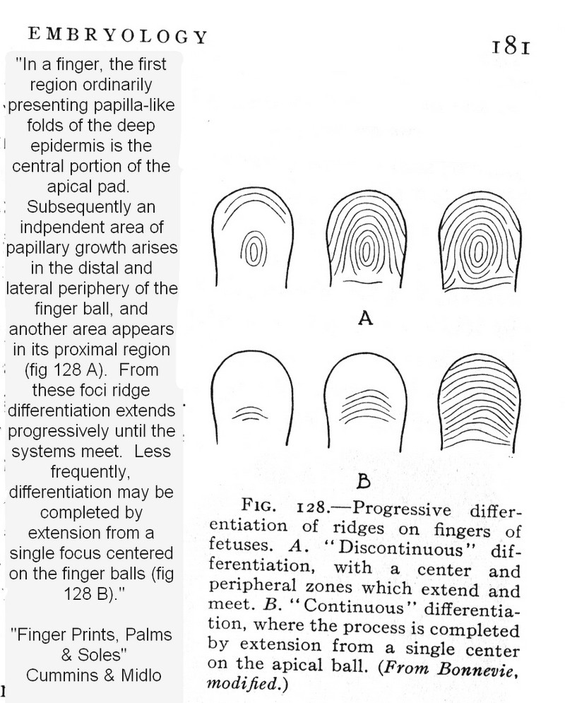 X - WALT DISNEY - One of his fingerprints shows an unusual characteristic! - Page 9 Cummin10
