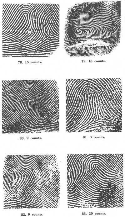 X - WALT DISNEY - One of his fingerprints shows an unusual characteristic! - Page 23 Fig07810