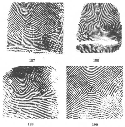 X - WALT DISNEY - One of his fingerprints shows an unusual characteristic! - Page 10 Fig18710