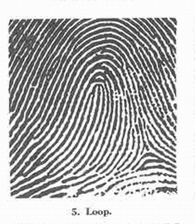 X - WALT DISNEY - One of his fingerprints shows an unusual characteristic! - Page 23 Fig_510