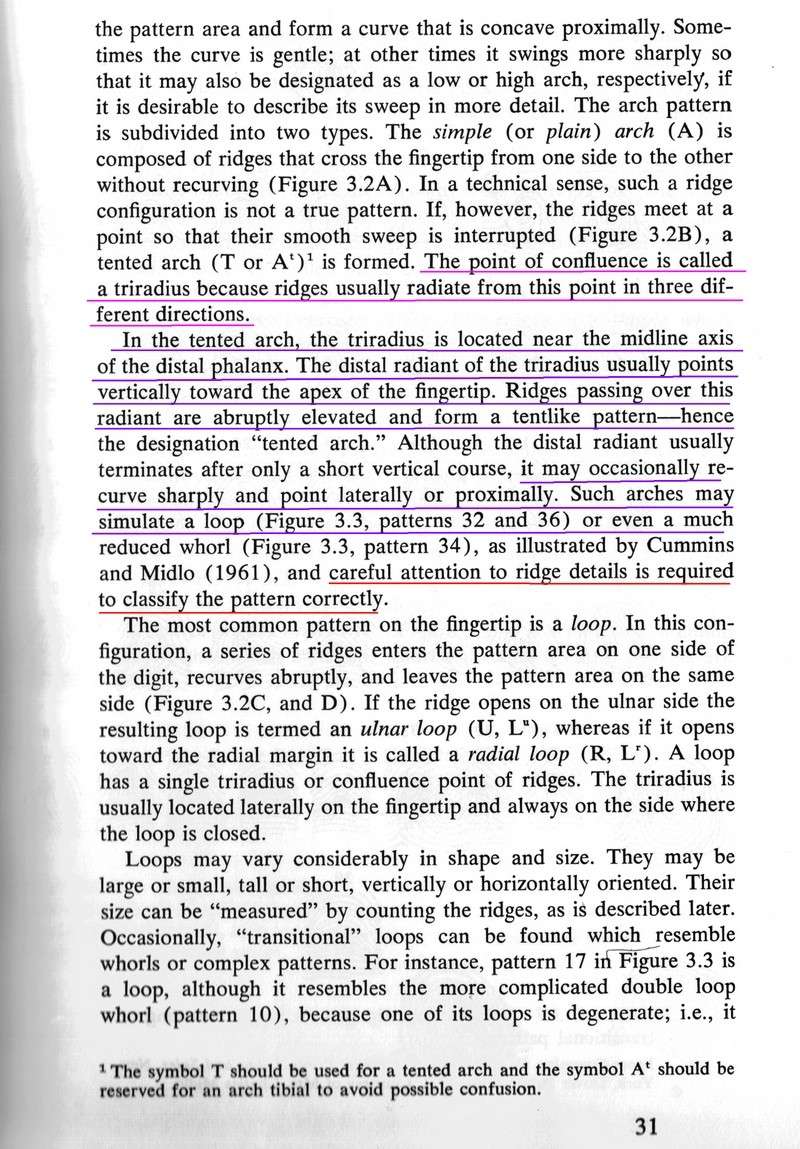 X - WALT DISNEY - One of his fingerprints shows an unusual characteristic! - Page 25 Trirad11