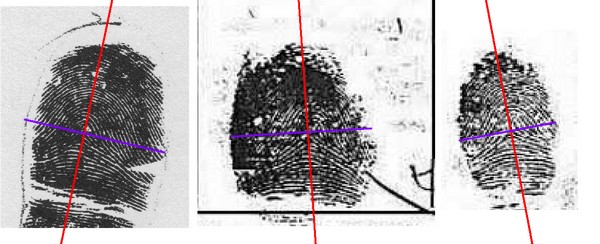 X - WALT DISNEY - One of his fingerprints shows an unusual characteristic! - Page 25 Trirad13