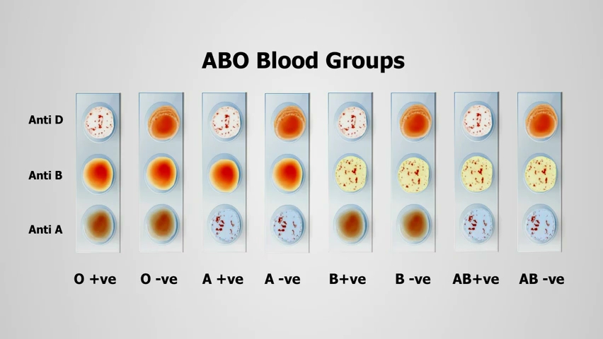 TD et TP n2 d'immuno: systeme ABO rhésus Quiz_f10