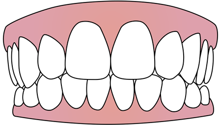 Οδοντοστοιχία Tooth_10
