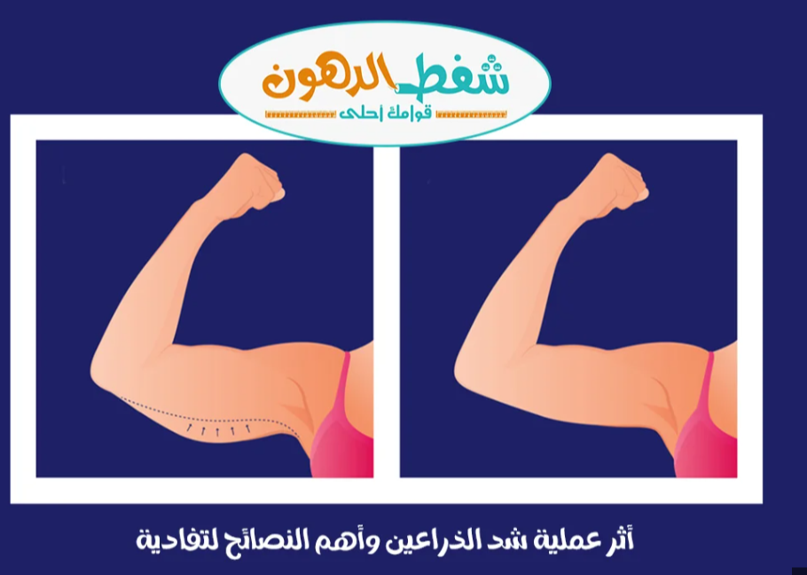 أثر عملية شد الذراعين Screen40