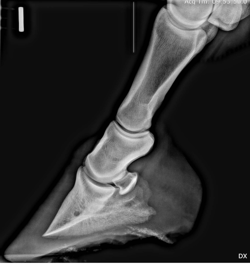 évolution d'un pied bot 0ca57316