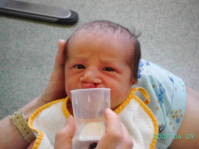 vécu de l'allaitement de votre bébé? Redime11