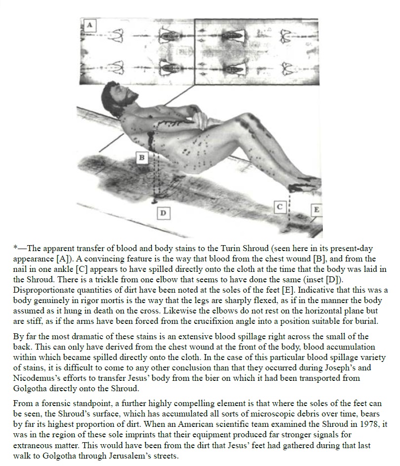 The Shroud of Turin:  Christ's Evidence of the Resurrection 1521